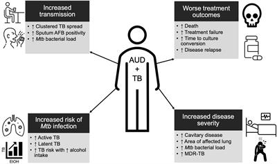 The Impact of Alcohol Use Disorder on Tuberculosis: A Review of the Epidemiology and Potential Immunologic Mechanisms